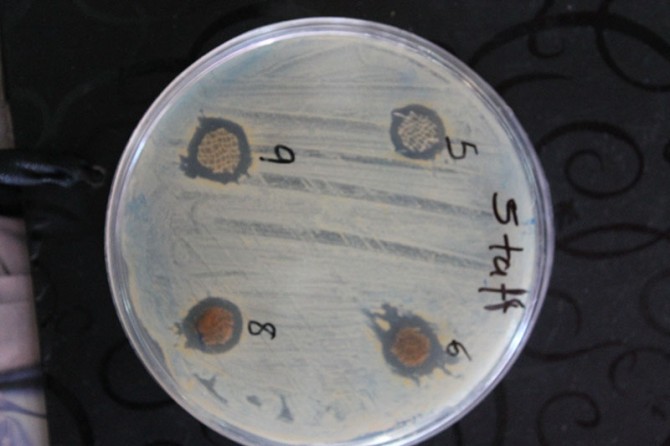 فرش ضد میکروب